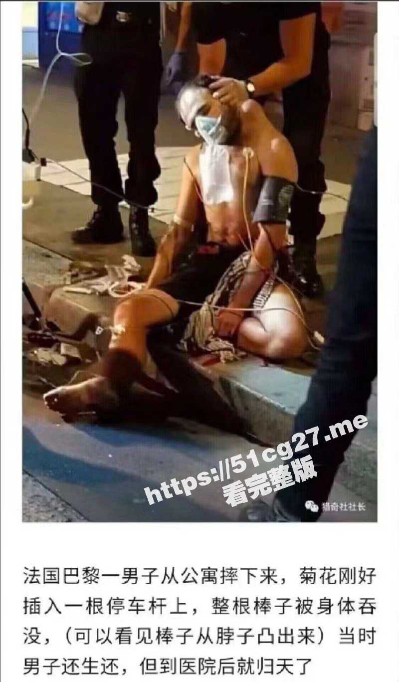 法国巴黎一名男子 从公寓楼摔下 菊花刚好插入一根停车杆！ - 51吃瓜网-51吃瓜网